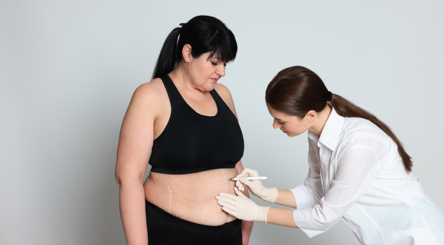 How Much Does Bariatric Surgery Cost