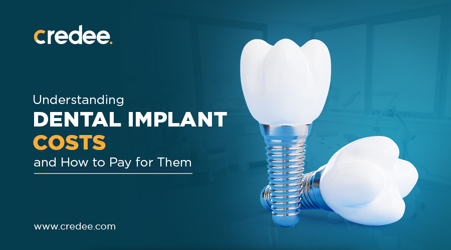 How Much Do Dental Implants Cost ( in 2024 ) Credee